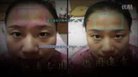 朵妍清祖?zhèn)髦兴幟婺?祛斑價格西紅柿祛斑的小竅門面部黃褐斑