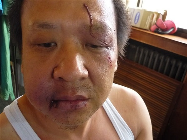 http://www.newswatch247.com/pics/default/download/7d6c533dcc1eff685edbde7bb9a0d593.jpg